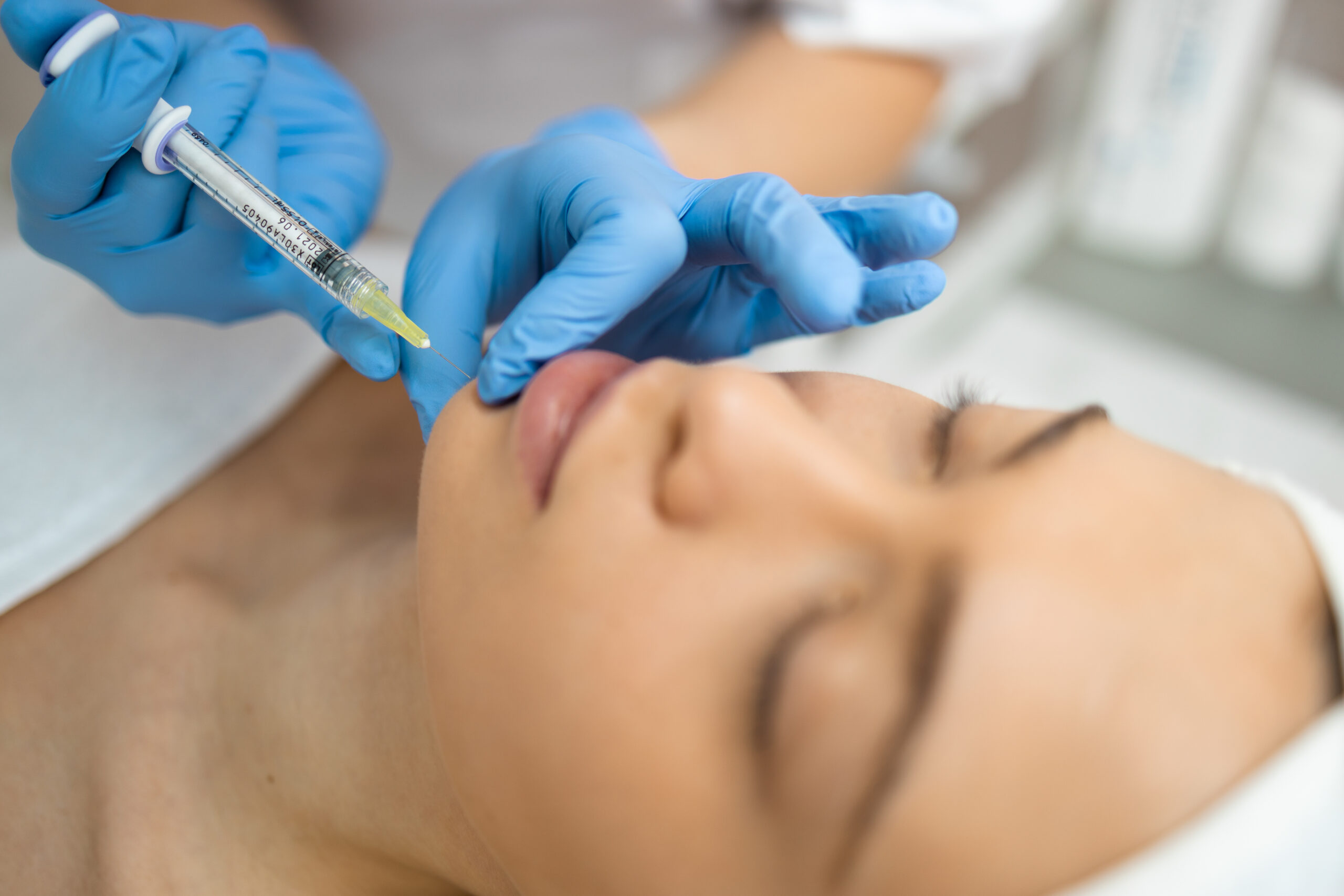 Dermal Fillers